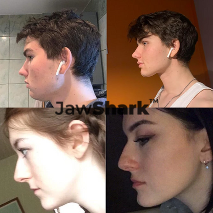 JAWSHARK™ Jaw Toner Facial Trainer